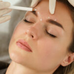 Botox: 10 Gründe warum Boto schneller nachlässt