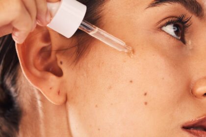 Was bewirkt der Wirkstoff Tranexamsäure für die Haut?