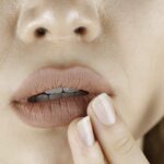 Lysin: Hilft die Aminosäure gegen Herpes?