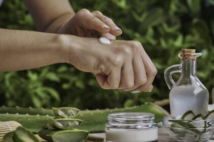 Sonnenbrand? Diese Hausmittel können helfen