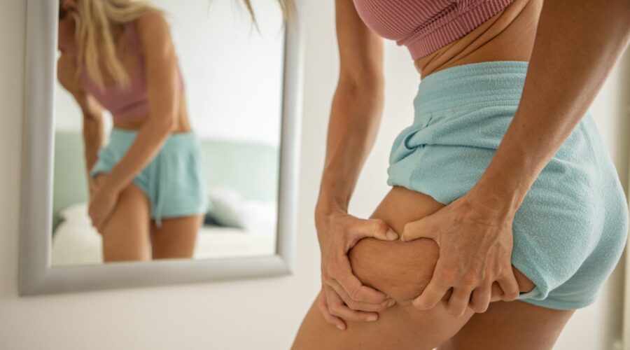 Cellulite bekämpfen: So kannst du deine Haut straffen