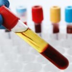 Bluttest für Vitaminwerte: Wann ist es sinnvoll?