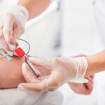 Testosteronwerte: Was dir der Bluttest sagen kann