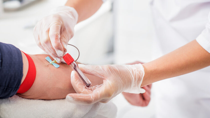 Testosteronwerte: Was dir der Bluttest sagen kann