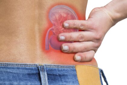 Was der Kreatininwert über deine Gesundheit sagt