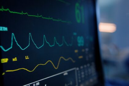 Herzfrequenz: Dieser Puls ist gefährlich