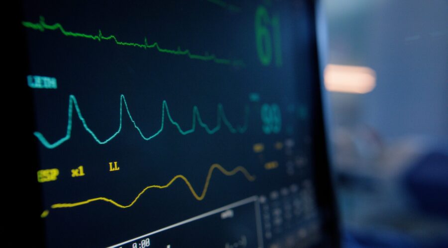 Herzfrequenz: Dieser Puls ist gefährlich