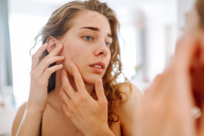 Retinol Uglies
