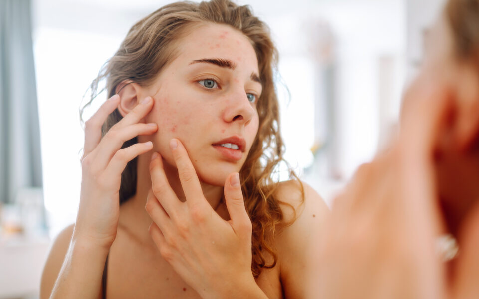 Retinol Uglies