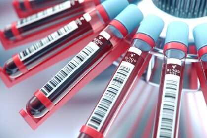 Spezialisierte Bluttests