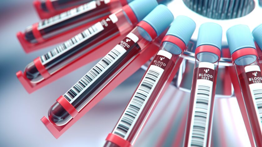 Spezialisierte Bluttests