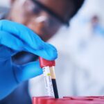 Diese Krankheiten erkennt der Bluttest
