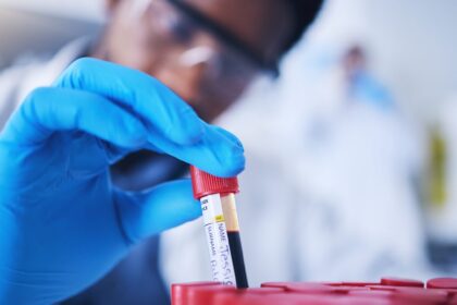 Diese Krankheiten erkennt der Bluttest