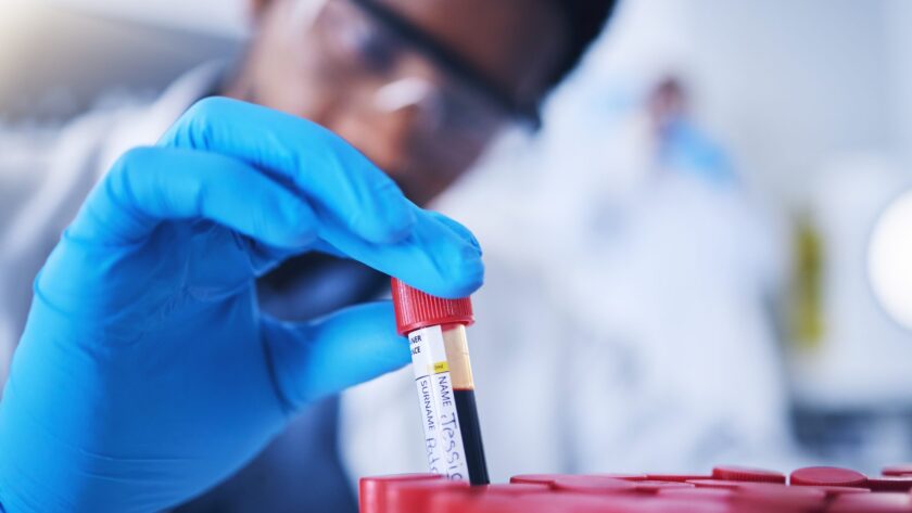 Diese Krankheiten erkennt der Bluttest