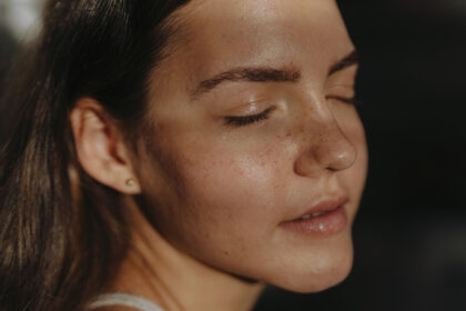 geschlossene Komedonen